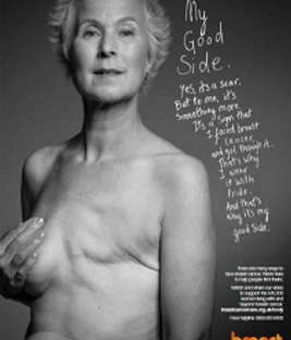 breast cancer care poster